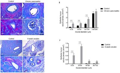 Ductal Mucus Obstruction and Reduced Fluid Secretion Are Early Defects in Chronic Pancreatitis